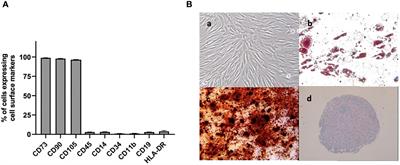 Age-related changes in human bone marrow mesenchymal stromal cells: morphology, gene expression profile, immunomodulatory activity and miRNA expression